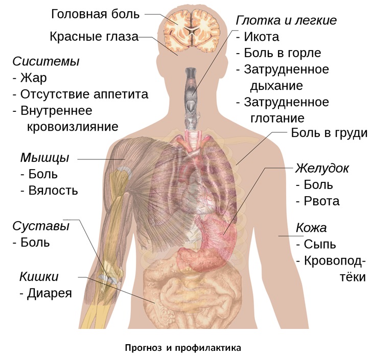 Понос (диарея) - что это, причины, лечение и диагностика